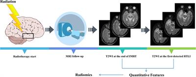 MRI-based radiomics models predict cystic brain radionecrosis of nasopharyngeal carcinoma after intensity modulated radiotherapy